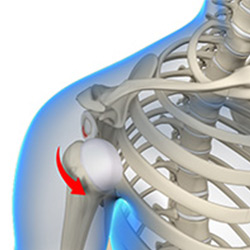 Anterior Shoulder Instability