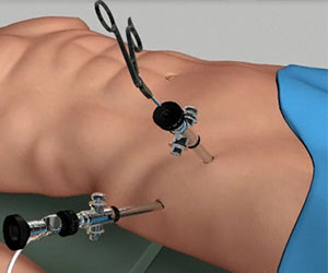 Hip Arthroscopy - Supine Position