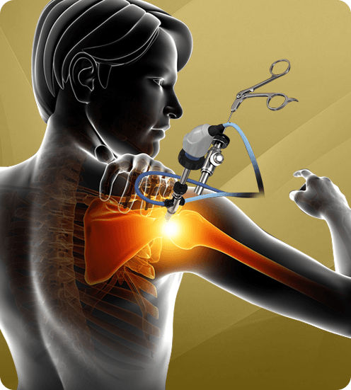 Picture of Advanced Arthroscopic Surgery