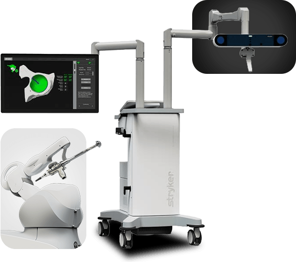Picture of Direct Anterior Minimally Invasive Hip Replacement