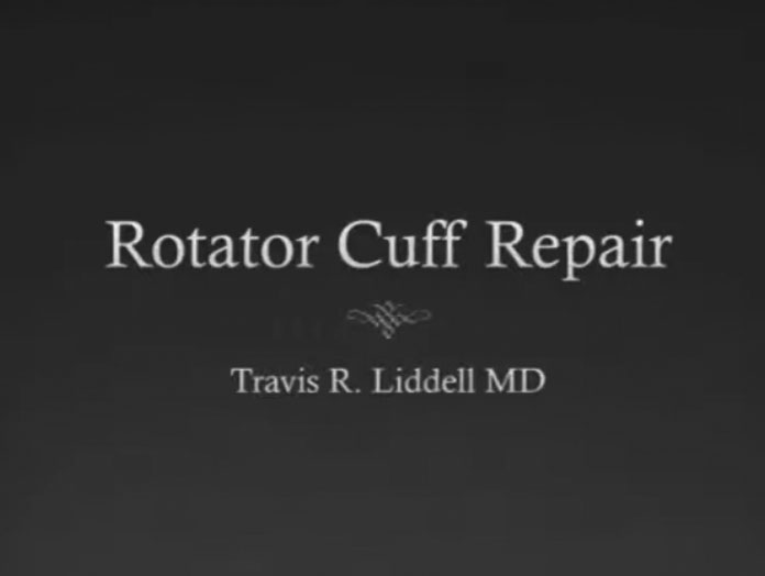 Picture of Hip Scope Labral Repair