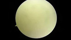 Meniscal Allograft Transplantation made simple A how to guide PART 1 sp