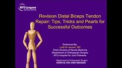 Revision Distal Biceps Repair Tips Tricks and Pearls for Successful Outcomes sp