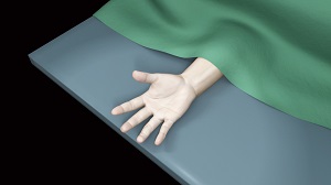 Wide Awake Hand Surgery