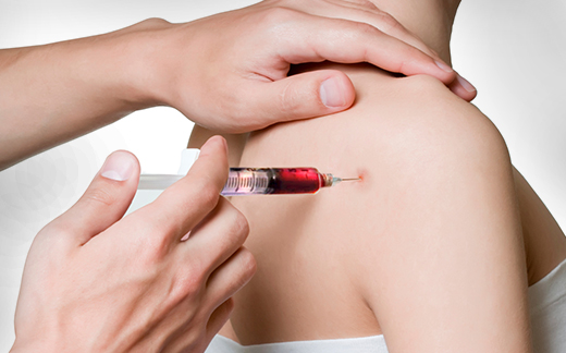 PRP Injection