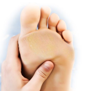 Calluses