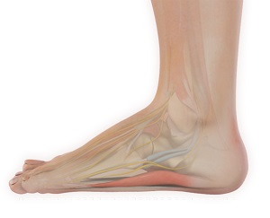 Adult Acquired Flatfoot