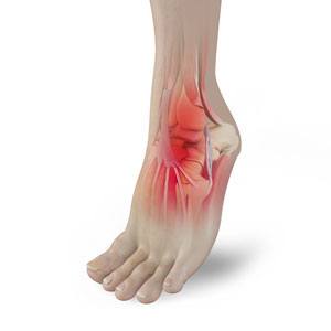 Foot Pain pic