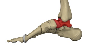 Talus Fractures