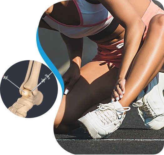 Ankle Arthroscopy