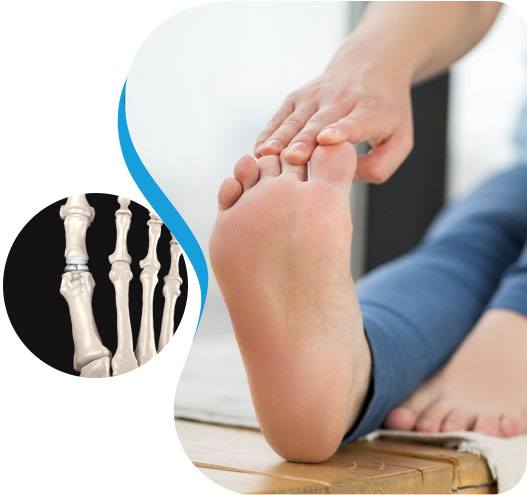Big Toe Replacement