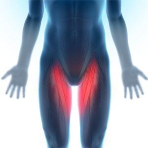 Groin Injuries in Athletes