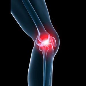 Knee Pain