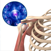 Orthobiologic Treatment for Shoulder Image