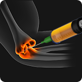 Orthobiologics 