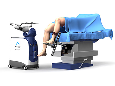Robotic Knee Replacement - Educational Picture