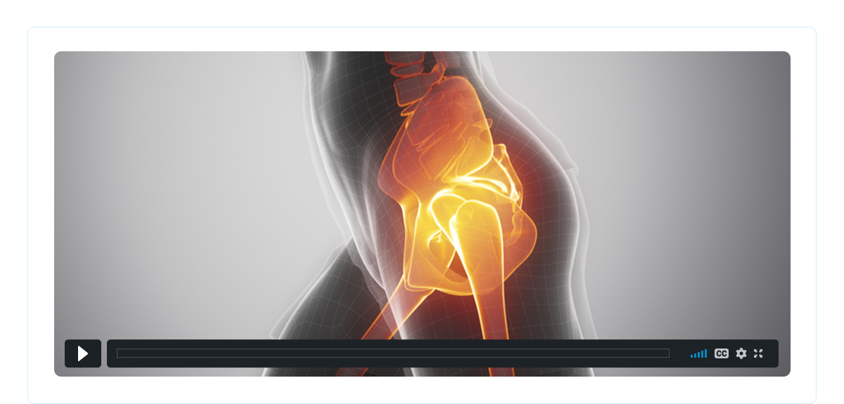 Patient Education Videos