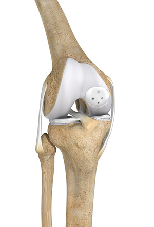 Knee Cartilage Restoration Images