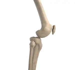 Knee Dislocation Images