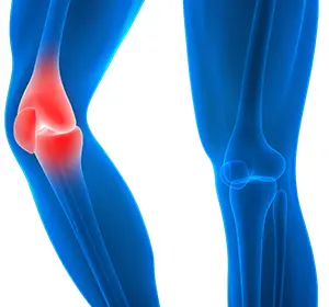 Knee Injury Images