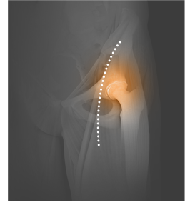 Outpatient Joint Replacement Images
