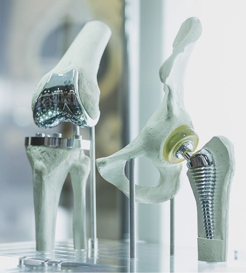 Picture of Hip & Knee Replacement