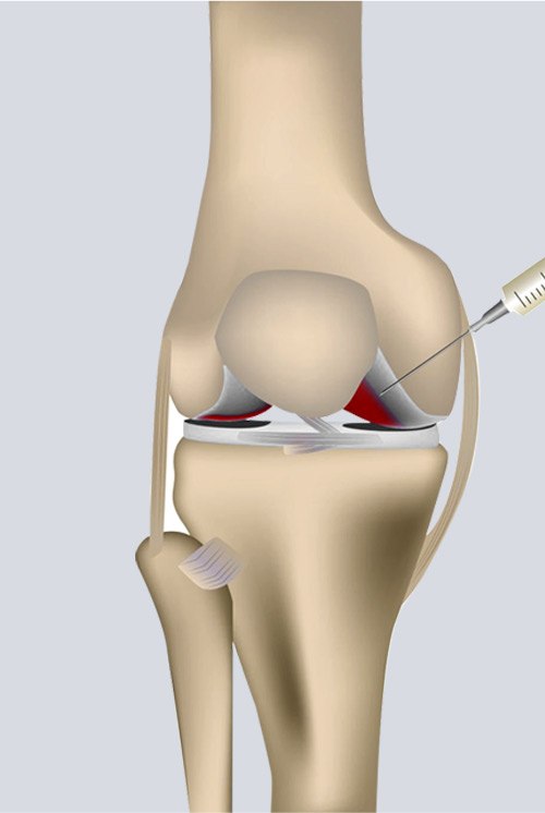 Picture of Regenerative Medicine