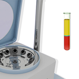 Platelet-Rich Plasma (PRP)