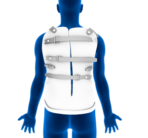 Scoliosis Treatment images