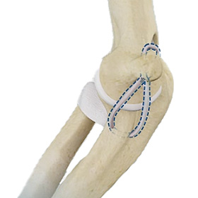 UCL Reconstruction images