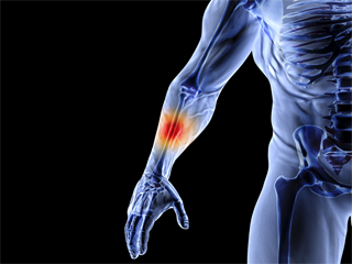 Work Related Hand Injuries images