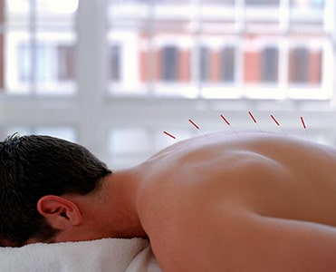 Acupuncture Images2