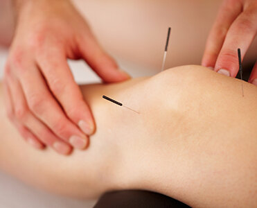 Acupuncture Images3