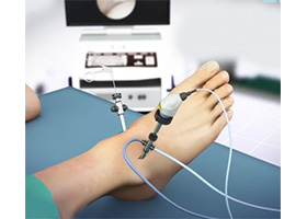 Ankle Arthroscopy