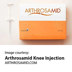 Arthrosamid Knee Injection