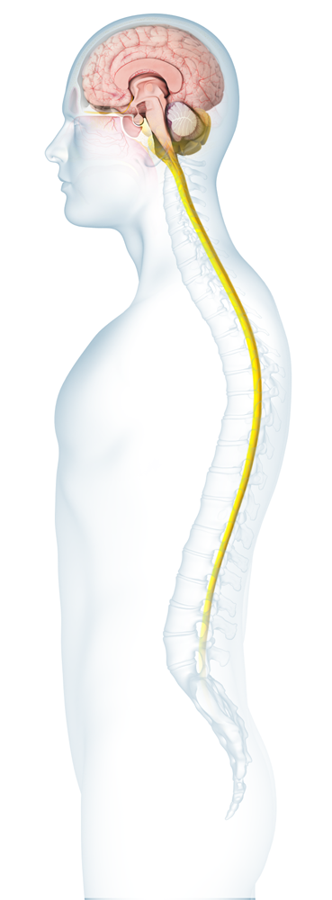 Chordoma Images