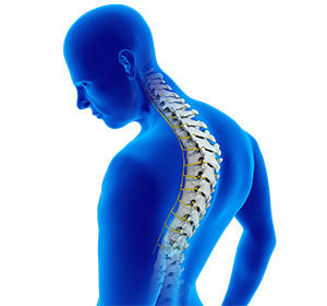 Kyphosis Images