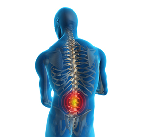 Low Back Pain Images