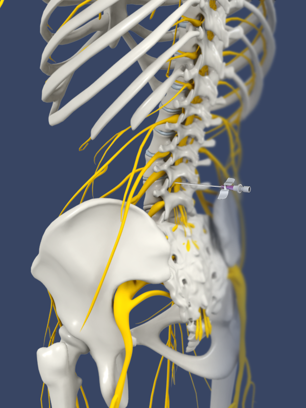 Lumbar Sympathetic Block Images
