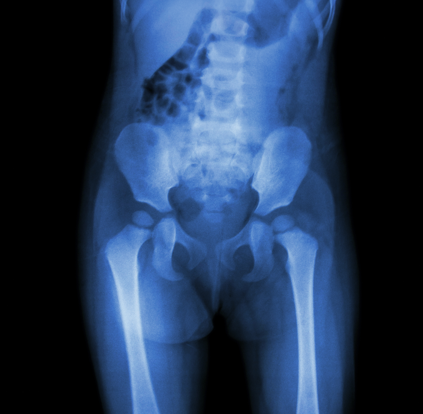 Paediatric Spine Images