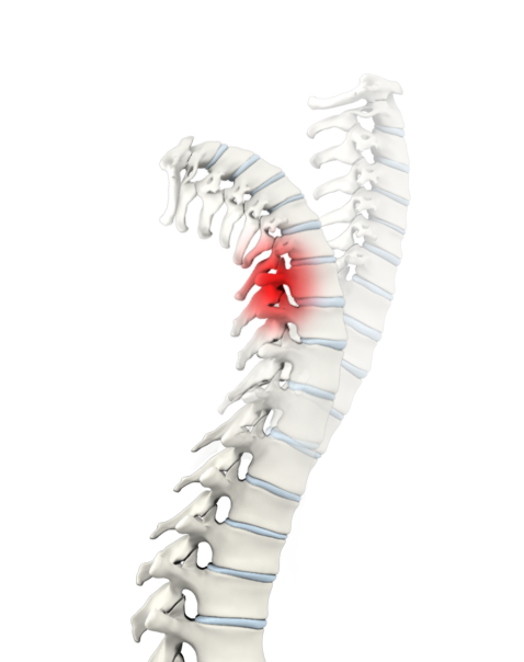 Whiplash Images