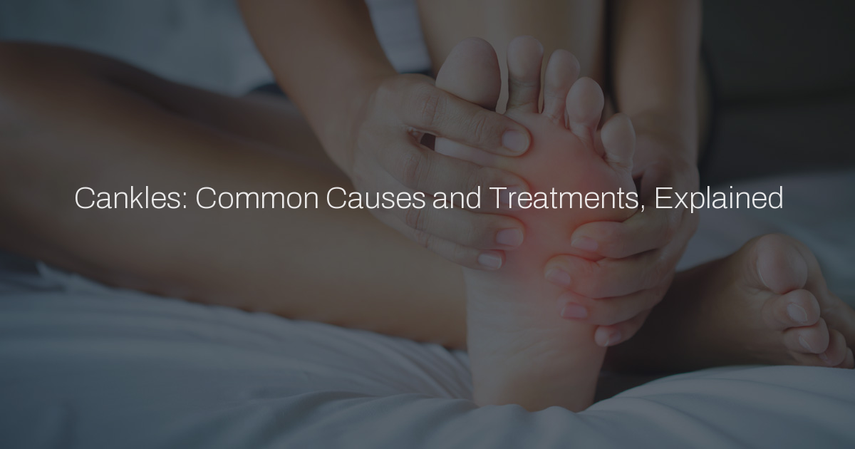 Cankles: Common Causes and Treatments, Explained