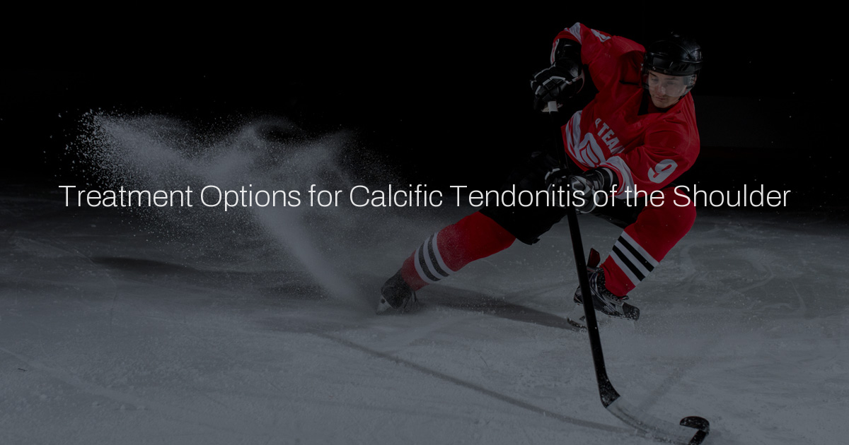 Treatment Options for Calcific Tendonitis of the Shoulder